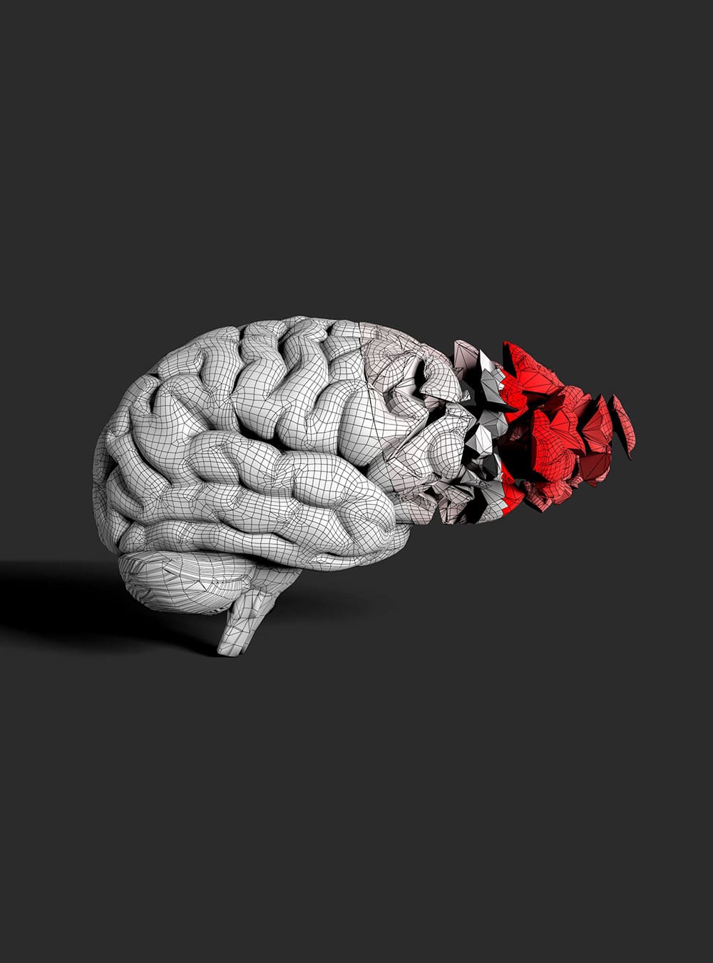 brain injury 3d graphic